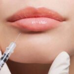Botox users getting younger after a year of Zoom meetings, doctors say